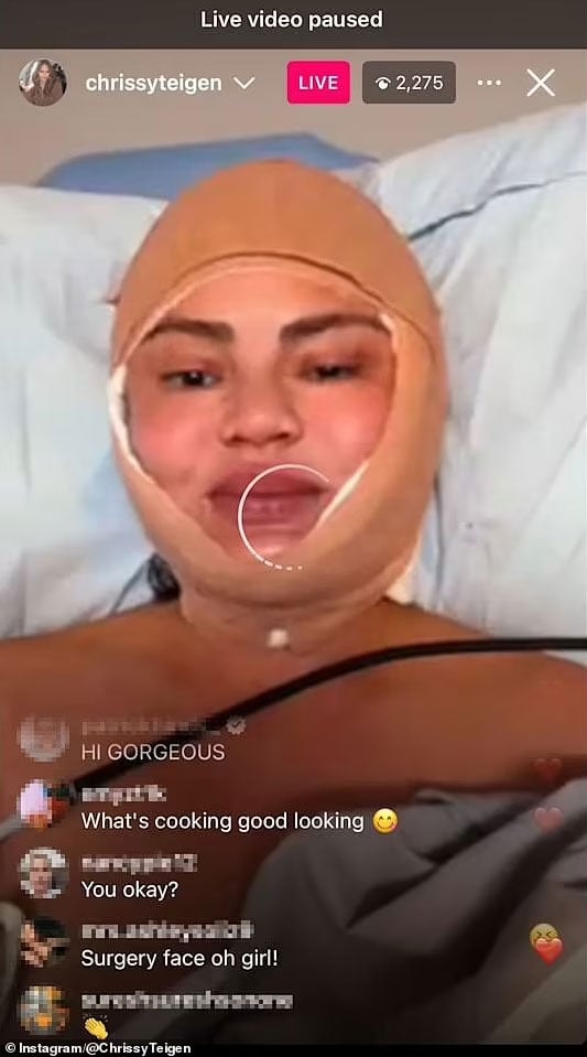 Chrissy Teigens Surgery Details are coming forward