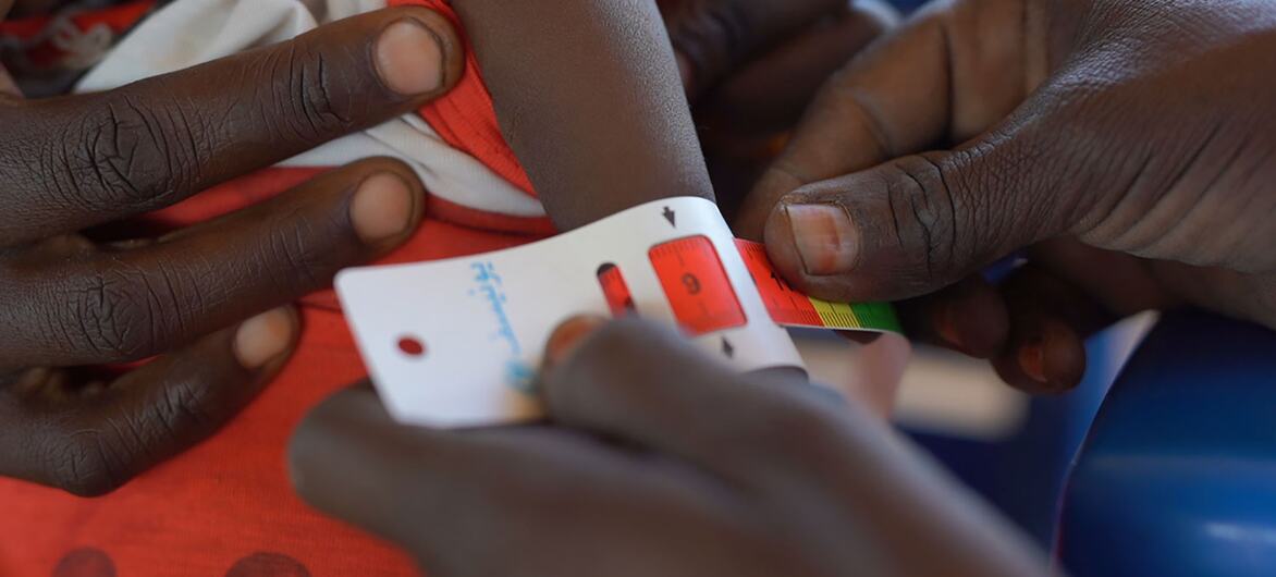 A close-up of hands using a tape measure to assess a child's arm circumference at a UNICEF-supported nutrition center in Tawila, North Darfur, Sudan, for early detection of malnutrition.