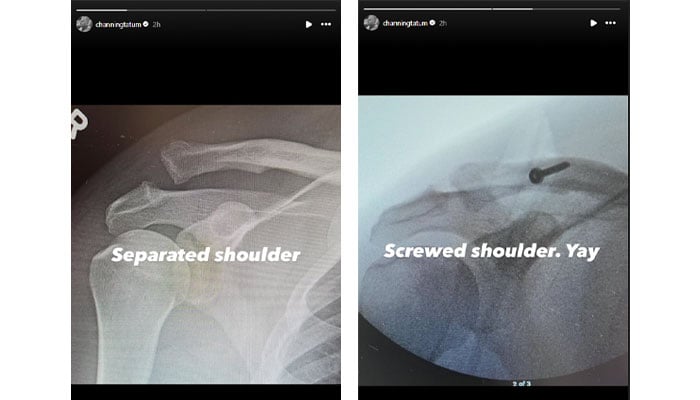 Channing Tatum is preparing to undergo surgery after a serious injury